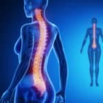 38934790 – spine blue x–ray bone scan