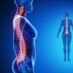 38934792 – spine blue x–ray bone scan