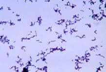 Acne-Causing Bacteria Might Also Fight Skin Disease