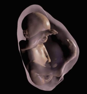 3D virtual model MRI view of fetus at 26 weeks. Credit: Radiological Society of North America