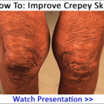 aging-knees-ad