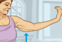 Lift Sagging Skin Without Surgery?