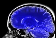 Brain Volume Could Predict Weight Loss Success