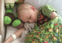 7-Year-Old Boy Gets 3D-Printed Skull Implant