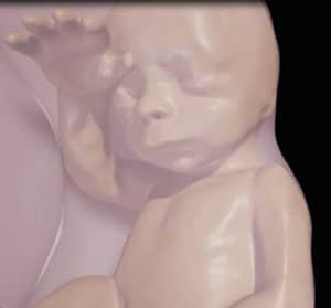 Close-up of fetus at 26 weeks. Credit: Radiological Society of North America