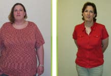 Weight Loss Surgery Gives Bigger Heart Benefits to Women