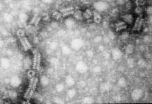 This Year’s Mumps Outbreak Was the Largest in a Decade