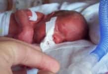 Groundbreaking Study Offers Glimpse of New Ways to Prevent Preterm Birth