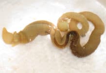 Studying Worm DNA Could Teach Humans How to Regrow Limbs