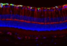Hormones Could Explain Why Certain Tumors Cause Vision Loss in Girls