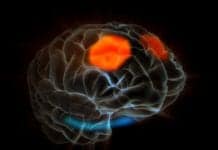 Forget Something? Your Brain May Be ‘Resting’