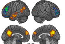 Here’s What Happens in Your Brain When You Talk Politics