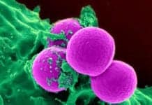 Dirty Dozen: Here Are the World’s Most Dangerous Bacteria