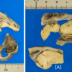 Screen-Shot-2017-01-11-at-2.20.09-PM-300×165