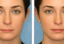 Scientific Formula Reveals ‘Ideal’ Female Lips