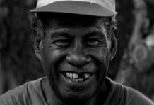 Losing Several Teeth Before 65 May Increase Risk of Death