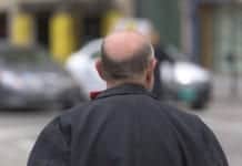 Shorter Men Might Be More Likely to Bald Prematurely