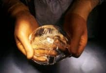 Breast Implant Type May Increase Risk of Developing Rare Cancer
