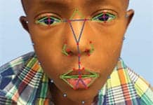 New Facial Recognition Technology Can Detect Rare Disease