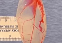 Scientists Grow Beating Heart Cells on Spinach Leaves