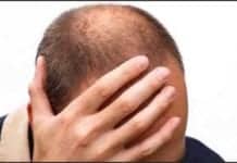 Hairs Send Signals to Each Other About When to Grow