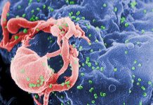 Scientists May Be Getting Closer to Curing HIV