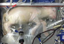 New Artificial Womb May One Day Save Premature Babies