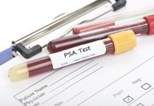 Task Force Dials Back on Prostate Screening Recommendations