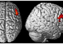 Brain Stimulation Can Boost Honesty, Limit Selfish Feelings