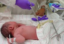 Umbilical Cord Blood May Boost Memory and Learning