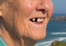 Tooth Loss May Lead to Increased Risk of Premature Death in Women