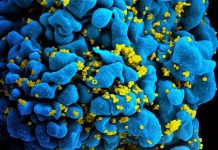 HIV Epidemic May Come to an End by 2025, Predicts Study