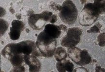 Researchers Get Closer to First Lab-Grown Blood Stem Cells