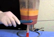 Plastic Surgery Goes Green With ‘Fat Recycling’