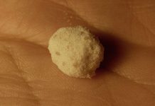 MDMA Moves Closer to Being PTSD Treatment