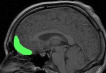 Risky Behavior Tied to Two Key Brain Regions