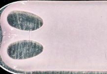 Lab-Grown Cartilage May Bring Relief to Osteoarthritis Sufferers