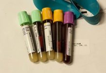 New Blood Test Aims to Detect Cancer Sooner Than Ever