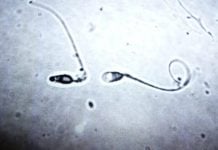 Sperm Counts Are Drastically Dropping Across Western Nations