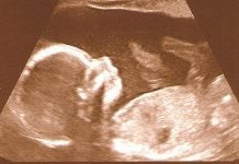 Baby Talk: Language Development Starts Prior to Birth