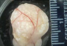 Artificial Ovaries Could Mean Less Harmful Hormone Therapies for Women