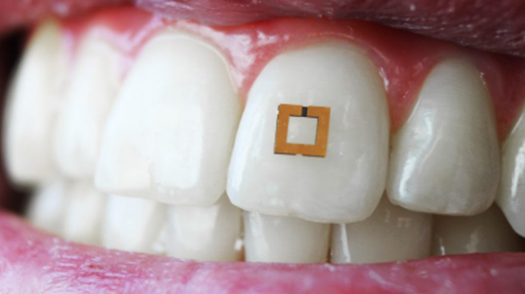 Scientists Create Sensor That Can Track What You Eat